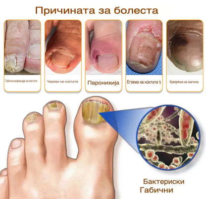 Габите исчезнуваат за 4 недели – природен спреј со матичен млеч!